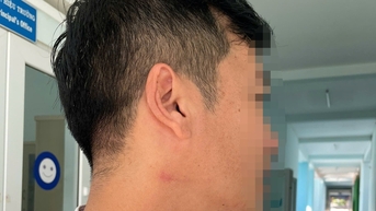 불법 주차를 경고했다는 이유로 학교 운동장 한가운데서 동료에게 목졸림을 당한 교사