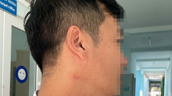 Bộ GD-ĐT yêu cầu xử lý vụ thầy giáo hành hung đồng nghiệp