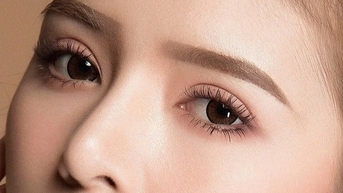 Cắt mí 5 ngày không nhắm được mắt, bác sĩ cảnh báo nguy cơ