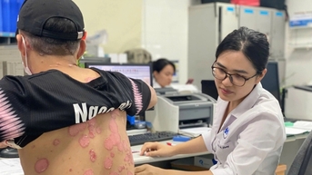 2 triệu người Việt mắc căn bệnh bong tróc da toàn thân