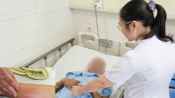 Nhiễm trùng huyết vì 'cấy chỉ’ chữa thoát vị đĩa đệm không đảm bảo an toàn