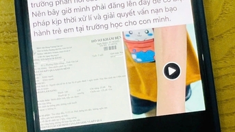 Phụ huynh tố giáo viên "dạy dỗ" học sinh quá tay