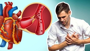Người bệnh tim mạch cần lưu ý gì trong mùa lạnh?