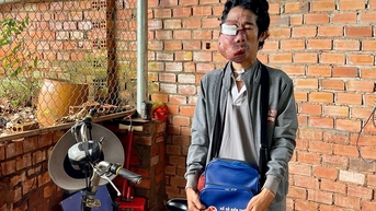 Khuôn mặt biến dạng, bệnh tật kéo dài, gia cảnh nghèo khó mong được giúp đỡ