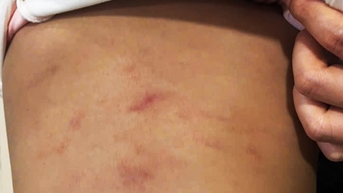 Công an vào cuộc vụ cô giáo đánh bé 2 tuổi ở Cà Mau