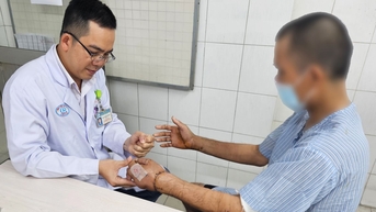 Nối liền hai bàn tay của người đàn ông bị hàng xóm chém đứt lìa do mâu thuẫn