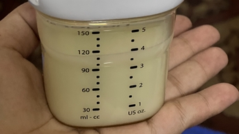 ទឹកដោះម្តាយមិនមែនជាអាហារសាមញ្ញទេ ប៉ុន្តែអាចផ្ទុកមេរោគបាន ប្រសិនបើមិនបានបញ្ចេញ ឬរក្សាទុកឱ្យបានត្រឹមត្រូវ។