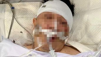 Tông xe trúng chó chạy rông, nam thanh niên té dập não nguy kịch