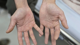 Đứng dậy là ngã, sau thời gian dài hít bóng cười