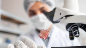 Liệu có thể chữa ung thư bằng cách điều chỉnh vi sinh trong mô u?