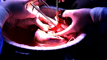 "Món quà để lại dương thế" của người quân nhân hồi sinh 6 cuộc đời