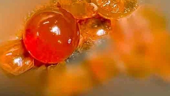 ការស្ទះពោះវៀនដោយសារតែការពង្រីកគ្រាប់ពូជ