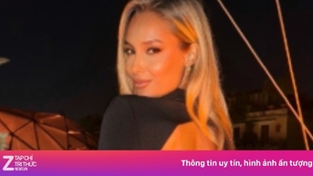 Võng lưng gây chú ý của 'búp bê Barbie sống'