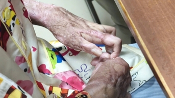 Thiếu nữ 17 tuổi bị bạn đốt keo nến làm cháy khắp người, phải mổ 15 lần