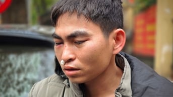 Nam shipper bị hành hung: 'Tôi còn đau đầu, đang được công an đưa đi giám định'