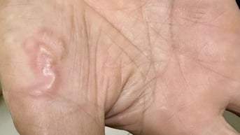 Làm thế nào phòng ngừa nhiễm giun sán từ thú cưng?