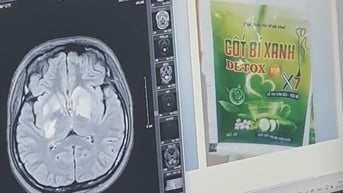 Thêm 1 cô gái bị tổn thương não vì dùng sản phẩm giảm cân chứa chất cấm