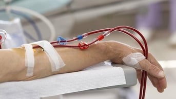 Chuyên gia nói gì về thông tin 'lọc máu giúp loại bỏ máu xấu, ngừa đột quỵ'?