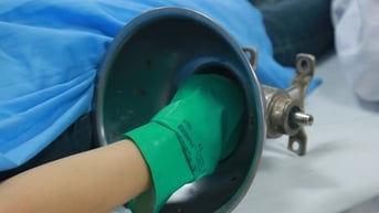 Người phụ nữ ở Hà Nội đi cấp cứu với chiếc máy xay thịt trên tay
