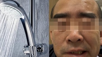 Uống rượu về rồi đi tắm, sáng dậy miệng méo xệch nhưng không do đột quỵ