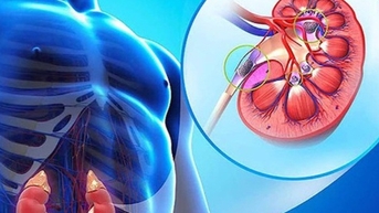 10 thực phẩm rẻ tiền bổ thận đang bán đầy chợ Việt, người bệnh thận nên ăn để phòng biến chứng