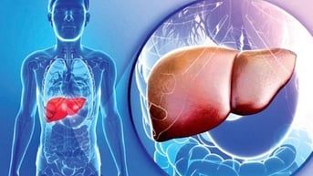 Không phải rượu bia, đây mới là thói quen âm thầm 'tàn phá' gan, tăng nguy cơ mắc bệnh gan đáng sợ nhất