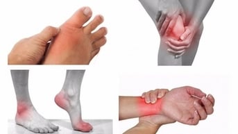 Người bị viêm khớp kiêng ăn gì?