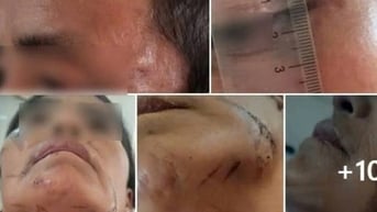 Bị đánh đập, treo lên cây do bị nghi làm bùa ngải khiến người khác tử vong