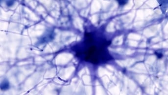 AI phát hiện ra nguyên nhân gây bệnh Alzheimer và có thể tìm ra phương pháp điều trị
