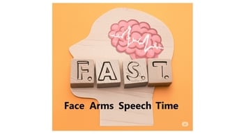 Nguy cơ tái đột quỵ ở bệnh nhân rung nhĩ