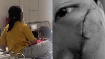 Bé gái co giật sau khi bị đánh bằng xẻng tại mái ấm ở TPHCM hiện ra sao?