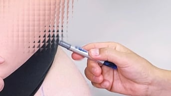 Nữ Việt kiều mắc hội chứng cực hiếm, tưởng nhầm "béo phì" suốt 20 năm