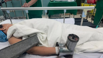 Sốc với hình ảnh người phụ nữ nhập viện cùng chiếc máy xay thịt