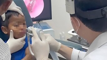 Gắp ra con đỉa sống ký sinh trong mũi bệnh nhi