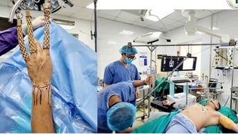 Bệnh viện 19-8 phẫu thuật nội soi nối rách đĩa sụn sợi tam giác cổ tay với trợ cụ đặc biệt tự tạo