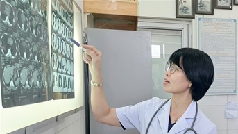 Lấy thành công xương cá dài hơn 1,5cm “trú” 5 tháng trong phế quản bệnh nhân