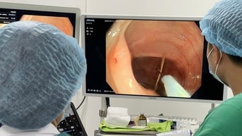 Đau bụng 1 năm mới phát hiện 3 xương cắm sâu trong đại tràng