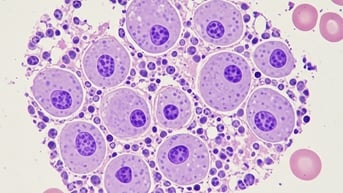 Nghiên cứu mới: Loại virus mới giúp điều trị ung thư chỉ sau 28 ngày
