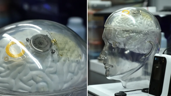 Trung Quốc đuổi sát Mỹ trong công nghệ não bộ, sánh ngang Neuralink