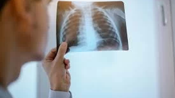 Xơ phổi có phải ung thư phổi không?