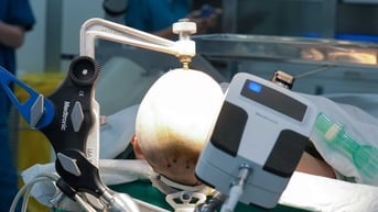 Công nghệ robot định vị Autoguide điều trị động kinh kháng trị