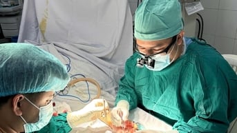 Nối thành công đốt tay bị đứt bằng kỹ thuật vi phẫu