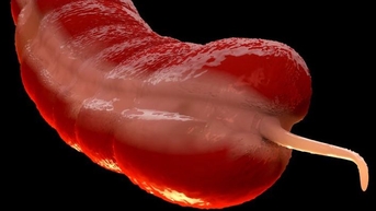 Một căn bệnh ung thư bị lãng quên đang gia tăng ở người trẻ khiến các chuyên gia bối rối