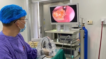 Hy hữu: Bị ngạt, không ngờ có sỏi trong hốc mũi