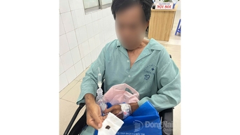 Nội soi gắp dị vật nằm trong phế quản bệnh nhân suốt 1 năm