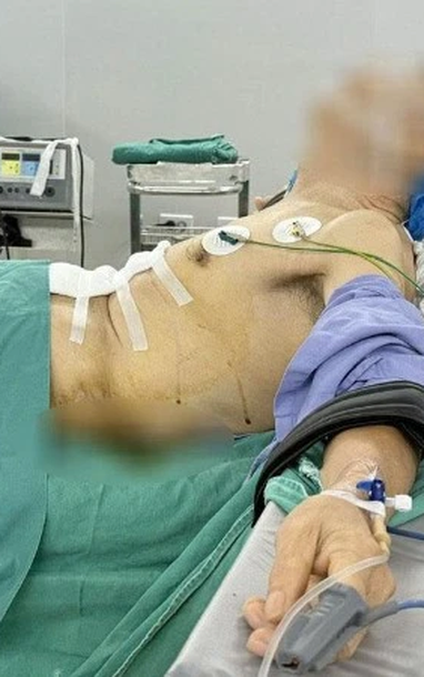 척추측만증이 심한 위암 환자를 위한 특수 수술