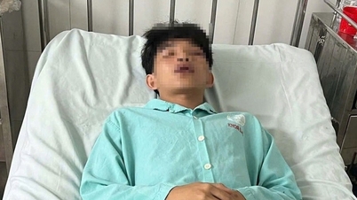 Nam sinh lớp 11 ở Bình Phước bị đánh hội đồng nhập viện