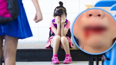 Con gái bị đánh gãy răng, người cha có hành động khiến nhiều người tức giận
