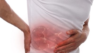 Surgery to remove kidney stone 5 times heavier than kidney