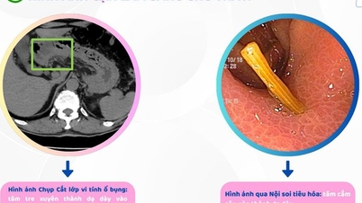 បុរស​ជនជាតិ​វៀតណាម​ជាច្រើន​នាក់​នៅ​ទីក្រុង Hai Phong ឈឺ​ពោះ​ពេញ​ខ្លួន សារភាព​កំហុស​របស់​ជនជាតិ​វៀតណាម